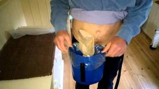 Emptying an ostomy bag using the Riksack from Stomaworks [upl. by Dulsea410]