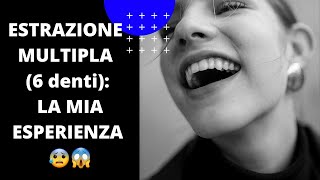 ESTRAZIONE DENTALE DI BEN 6 DENTI IN UNA SOLA SEDUTA la mia esperienza [upl. by Dorehs]