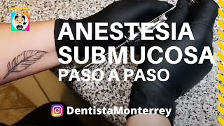 💉ANESTESIA SUBMUCOSA 👅 TÉCNICA en PACIENTE PASO a PASO [upl. by Lleryt]