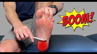 Heel Spur Treatment and Home Remedies 10 Ways to Easy Fast Relief  Dr Tarik Torki [upl. by Ihp]