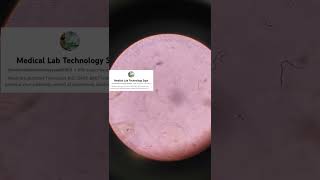 Starch in stool under microscope  medicallabtechnologysajal6903 [upl. by Atirehc]