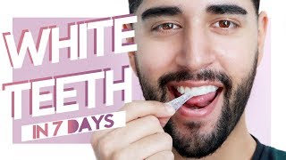 Whiter Teeth In 7 Days  At Home Teeth Whitening ✖ James Welsh [upl. by Custer153]