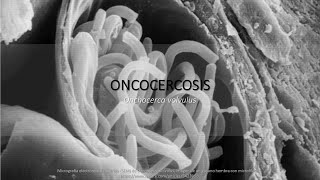 Oncocercosis BIOLOGÍA resumen  memorización [upl. by Shipley]