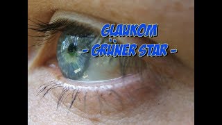 Erkrankungen der Augen  Glaukom oder grüner Star [upl. by Tertia44]