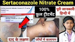 Sertaconazole nitrate cream 2 ww  sertaconazole cream  onabet cream kis kaam aati hai [upl. by Winonah]