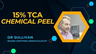 15 TCA Chemical Peel for Acne and Pigmentation acne chemicalpeels brownspots hyperpigmentation [upl. by Assisi]