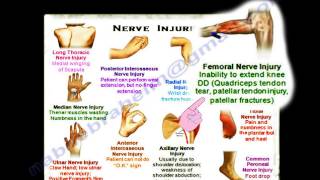 Nerve Injuries Summary Thank You Card  Everything You Need To Know  Dr Nabil Ebraheim [upl. by Isadore]