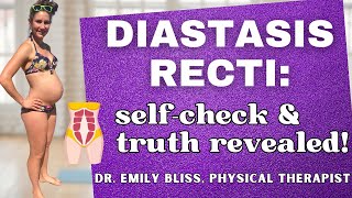 Unlocking the Truth How to SelfAssess Diastasis Recti amp Clearing the Myths [upl. by Steffin59]