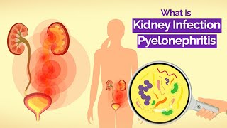 What Is Kidney Infection Pyelonephritis The Definitive Guide [upl. by Winnifred]