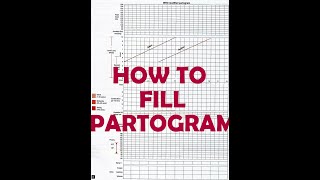 HOW TO FILL PARTOGRAM  VERY EASY [upl. by Alburga726]