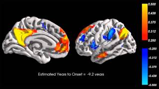 Intranetwork and Internetwork Default Mode Functional Connectivity [upl. by Buffum296]