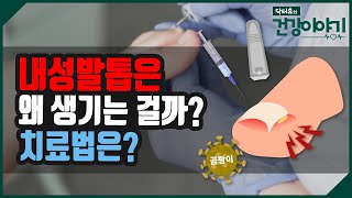 내성발톱은 왜 생기는걸까 치료법은 닥터유의 건강이야기 [upl. by Mackie]