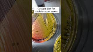 Catalase Test microbiology bpharm lifescience [upl. by Ecinreb]