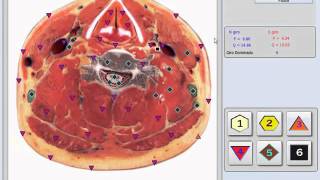 Bioplasm 10D NLS Modelo 2016 [upl. by Cornwell894]