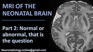 MRI of the neonatal brain part 2 Normal or abnormal that is the question [upl. by Arsuy]