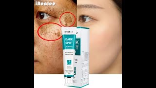 Whitening Freckle Cream Remove Melasma Dark Spot – iBeaLee™ [upl. by Hillinck569]