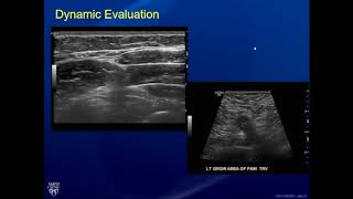 Ultrasound of Lumps and Bumps [upl. by Ytteb]