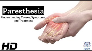 Paresthesia The Shocking Sensation You Need to Know About [upl. by Peedsaj]