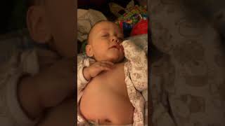 Example of Retractions Belly Breathing and Tachypnea in Infant [upl. by Salocin]