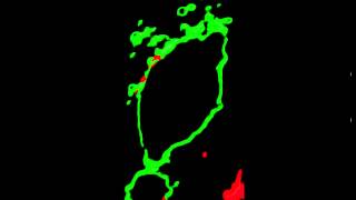 Kimberly Toops Endo and exocytosis in a retinal pigment epithelium cell [upl. by Ahtimat]