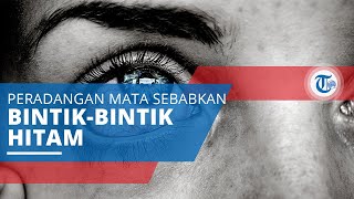 Iridosiklitis Penyakit Peradangan Mata Menyebabkan Mata Mengeluarkan Bintikbintik Hitam [upl. by Ateiram]