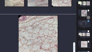 Areolar Adipose and Reticular Connective Tissues [upl. by Selmner787]