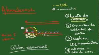 Degenerações Parte 1 Acúmulos Intracelulares  Resumo  Patologia [upl. by Ignace]