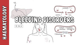 Approach to bleeding disorders  causes pathophysiology and investigations [upl. by Ena702]