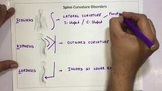 Spine Curvature Disorders  Scoliosis Kyphosis Lordosis [upl. by Nivloc]