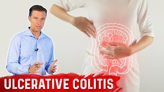 What is Ulcerative Colitis – Causes Symptoms amp Treatment by DrBerg [upl. by Leoj268]