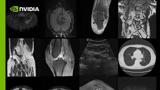 Create Infinite Medical Imaging Data with Generative AI [upl. by Corvese248]