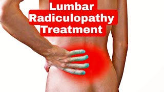 Best Treatment for Lumbar Radiculopathy  Nerve pain  Exercise for Radiated Pain in legs [upl. by Haletta704]