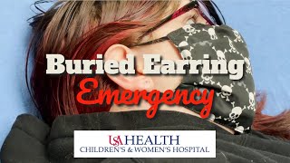 Buried Earring Emergency [upl. by Charisse]