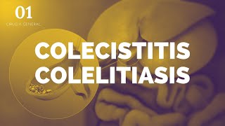 Colecistitis y Colelitiasis  ENARM [upl. by Boggers]