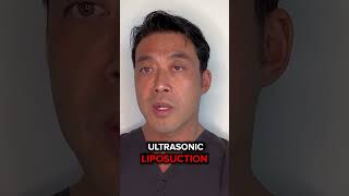 Top Benefits of Choosing Laser Liposuction [upl. by Orlan]