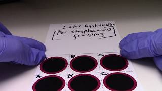 Latex Agglutination FOR Streptococcus Grouping [upl. by Anek593]