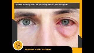 Dangers from Abrasive Wheels [upl. by Yessac]