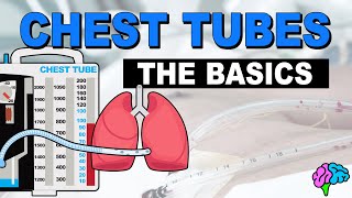 The Basics of Chest Tube Management [upl. by Enneles]