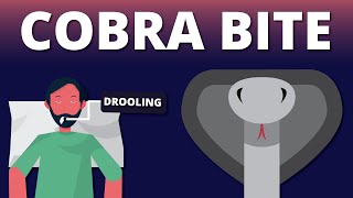 A case of Cobra Bite Emergency Snake Venom Animation [upl. by North]