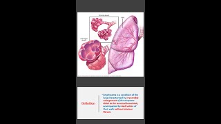 Shorts What is Emphysema [upl. by Lipscomb]