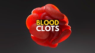 Blood Clots Causes Signs and Symtpoms Diagnosis and Treatment [upl. by Moir]