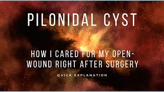 Pilonidal Cyst Open Wound Care My First Gauze Change [upl. by Eclud]