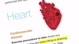 Diabetes and Exercise What precautions to take while exercising if I have diabetes amp heart problem [upl. by Limbert847]