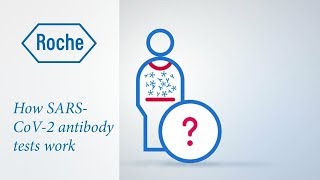 How do antibody tests work [upl. by Ecidnak571]