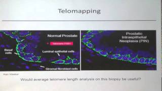 Dr Jerry Shay speaks about telomere measurement [upl. by Orten]