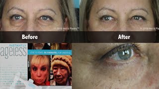 Instantly Ageless COMPLETE Review  Demo [upl. by Aziar]