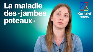 Atteinte de lipoedème ou maladie des jambes poteaux Manon est médecin et témoigne [upl. by Netram]