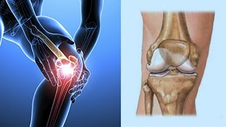 COMO REGENERAR EL CARTÍLAGO DE LA RODILLA MAS RAPIDO 2020 [upl. by Mailliw156]