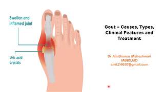 Gout  Types Clinical Features and Treatment  Hyperuricemia  Uric Acid  Biochemistry [upl. by Ardnoel82]