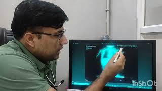 How to Interpret an Xray I Neonatologist I NICU [upl. by Yennek]